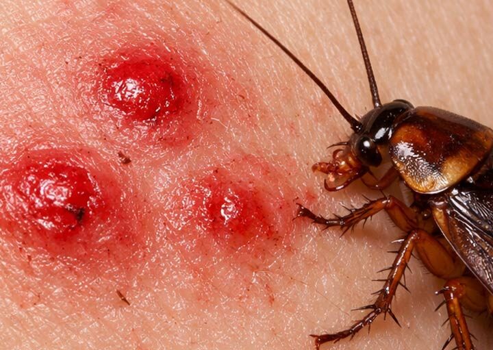 Hamam Böceği Isırır mı? hamam böceği ısırır mı